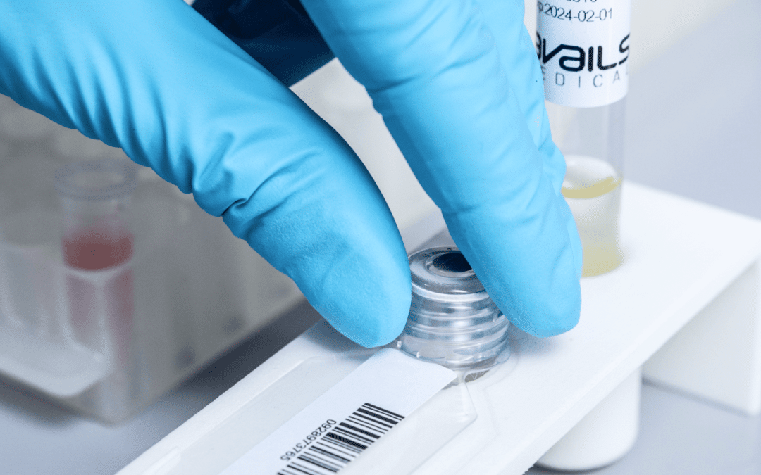 Avails Medical announces the commencement of U.S. Pivotal Clinical Trials for eQUANT™